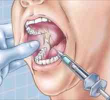 Anestezija v zobozdravstvu: vrste, opis in metode