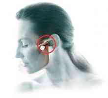 Arthritis of maxillofacial joint: simptomi in zdravljenje