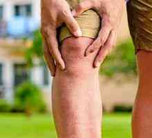 Artritis kolenskega sklepa: simptomi in zdravljenje