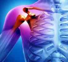 Arthritis ramenskega sklepa: simptomi in zdravljenje