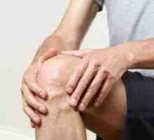 Osteoartritis kolenskega sklepa: zdravljenje z ljudskimi zdravili