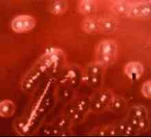 Bakterije streptococcus viridans (streptococcus viridans)