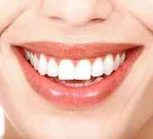 Bele pike na zobeh: simptomi, vzroki za nastanek pri odraslih in otrocih