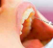 Ali je bolno odstraniti živec iz zoba?