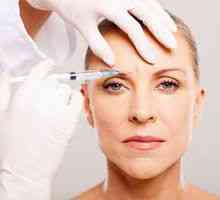 Botox v čelu: kaj morate vedeti o postopku in posledicah