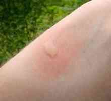 Kaj morate raztrgati komarjem z otrokom