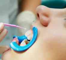 Kaj je koristno za fluoriranje zob?