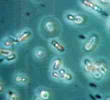 Kaj so anaerobne bakterije in anaerobne okužbe?
