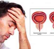 Kaj je adenoma prostate pri moških: vzroki, simptomi in zdravljenje