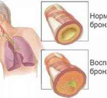 Kaj je bronhitis: znaki in zdravljenje vnetja?