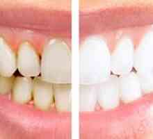 Kaj je higienično čiščenje zob?