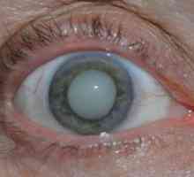 Kaj je oči očesa, simptomi