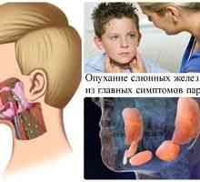 Kakšna bolezen mumpira na epidemijo: simptomi in zdravljenje