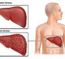 Kaj pomeni "nosilec hepatitisa c" in kaj je nevarno za človeka