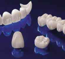 Cirkonijeve krone v sodobni zobozdravstvu