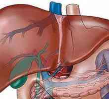 Ciroza jeter in njene zaplete. Koliko ljudi živi s ascitesom?