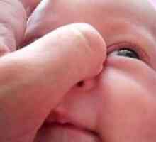 Dakriocistitis pri novorojenčkih, simptomi in zdravljenje