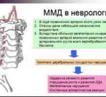 Diagnoza nevrologa mmd (minimalna možganska disfunkcija)
