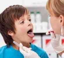 Faringitis pri otrocih: simptomi in zdravljenje