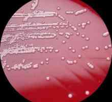 Hemolitični Staphylococcus aureus (staphylococcus haemolyticus)