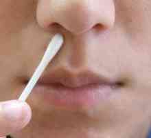 Herpes v nosu: simptomi, zdravljenje, mazila