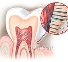 Hiperestezija zobnega emajla: vzroki, simptomi in zdravljenje