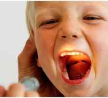 Purulent pluta v grlu: simptomi in zdravljenje