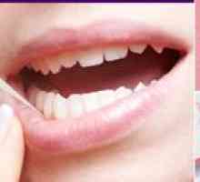 Učinek plazmoliftinga v zobozdravstvu