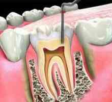 Endodontska zobozdravstvo v zobozdravstvu: kaj je to?