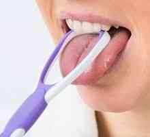 Kako očistiti jezik in odstraniti plaketo: načine za čiščenje