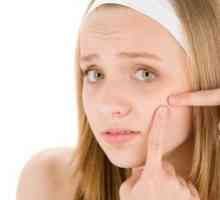 Kako se znebiti aken na obrazu mladostnikov