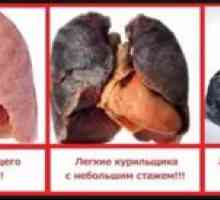 Kako se znebiti kadilca iz kašlja: kako zdraviti kajenje