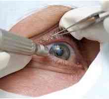 Kako zdraviti artefaktične oči in kaj je to