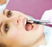 Kako prenehati krv po ekstrakciji zoba