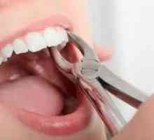 Kako odstranite korenine zob