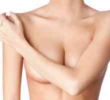 Kako odstraniti strije na prsih: kreme za odstranitev strije