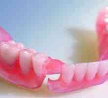 Kako izbrati zobne najlonske zobne proteze?