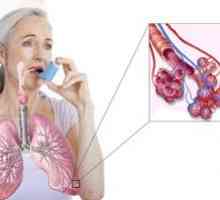 Kako pozdraviti astmo: se lahko znebim za vedno doma