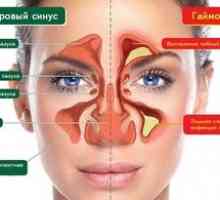 Kako zdraviti sinusitis brez prebadanja