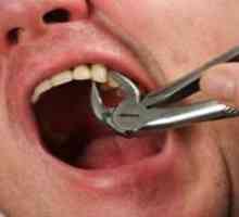 Kako raztrgati zob brez bolečin in strahu