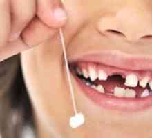 Kakšne otroške zobe se otroka spremenijo za trajno