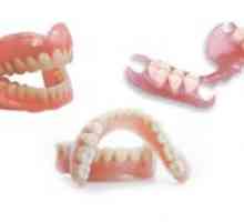 Kateri zobje je bolje vstaviti: različne vrste proteze