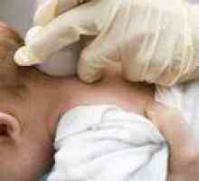 Cista v glavi pri novorojenčkih: vzroki in posledice