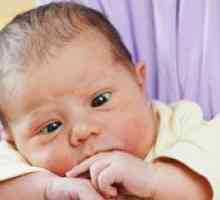 Kdaj se pri novorojenčkih pojavijo strabizem?