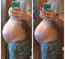 Kdaj se pri nosečnicah zmanjša trebuh?