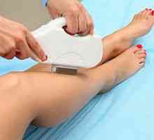 Laserska epilacija nog: opis in stroški