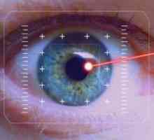 Lasersko odpravljanje vida: posledice in pregledi