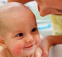 Zdravljenje atopičnega dermatitisa pri otrocih