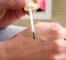Zdravljenje in zdravljenje papiloma in HPV