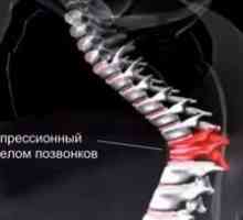 Zdravljenje starejših z zlomom hrbtenice zaradi kompresije